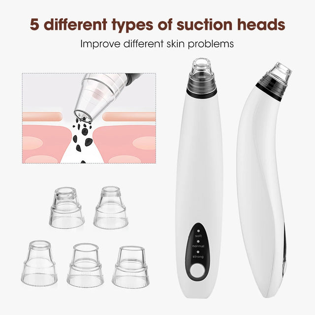 TouchUp And More: Wireless Camera Blackhead Remover