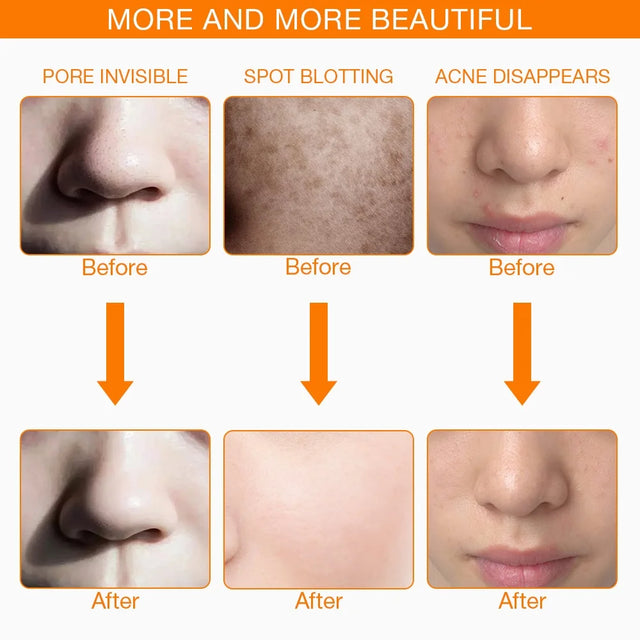 TouchUp And More: LED Skin Care Beauty Mask