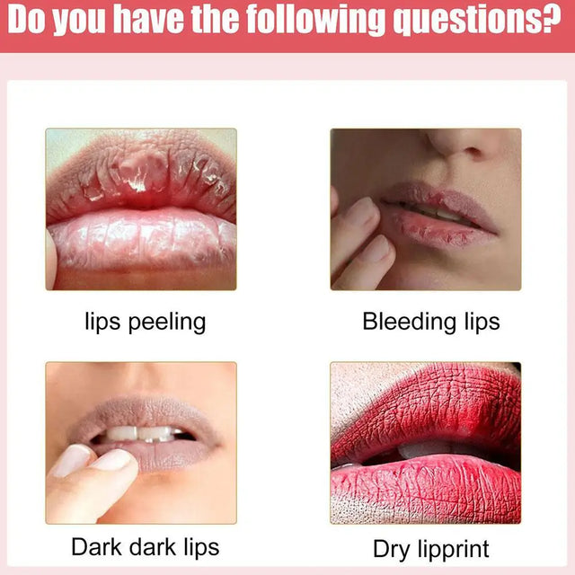 TouchUp And More: Lip Lightening Cream