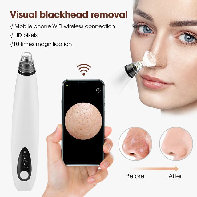 TouchUp And More: Wireless Camera Blackhead Remover
